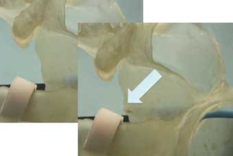 Figure 3. Model of a human left atrium