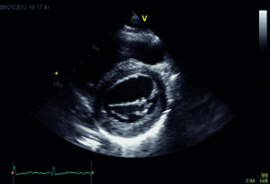 Figure 2 a-c B