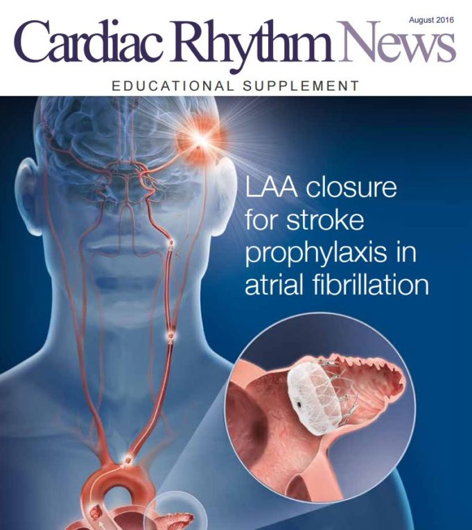 Educational supplement: LAA closure for stroke prophylaxis in atrial fibrillation