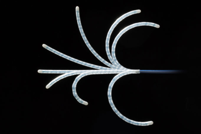 King’s College London joins with Cambridge Design Partnership to further develop a new steerable catheter to treat cardiac arrhythmias