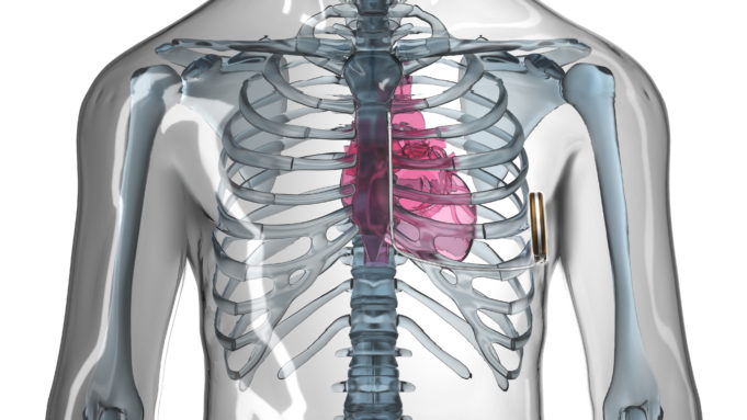 Boston Scientific announces scheduled presentations at Heart Rhythm Society 2017