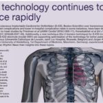 S-ICD avertorial