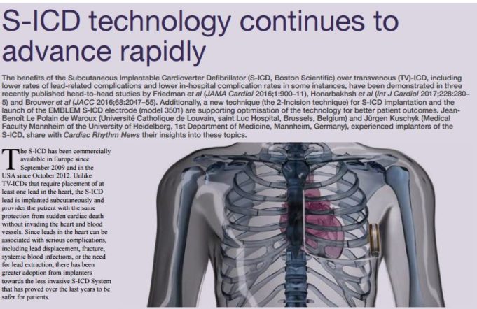 S-ICD technology continues to advance rapidly