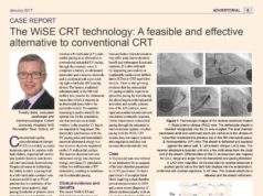 The WiSE CRT technology: A feasible and effective alternative to conventional CRT ‒ CASE REPORT