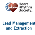 Lead-management-feature