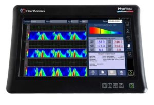 HeartSciences’ MyoVista wavECG Device with Informatics