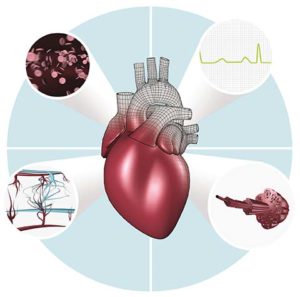 New ESC guidelines on SVTs