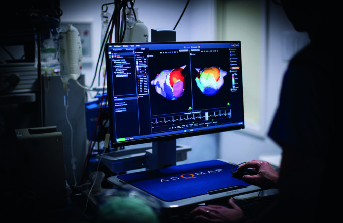 US FDA approval for second generation AcQMap system