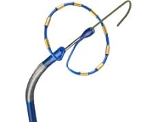 Phased RFA for AF shows efficacy and quality of life improvements