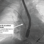 CRN 42 Fig 2