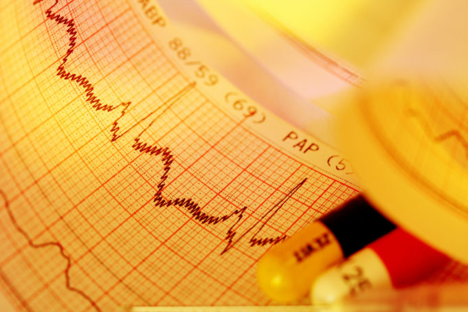 Artificial intelligence can use ECGs to work out physiological age