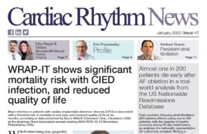 Cardiac Rhythm News Issue 47 – January 2020 Cardiac Rhythm News Issue 47