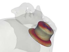 First patient enrolled in PREDICT-LAA clinical trial