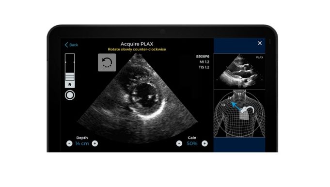 AI-guided cardiac imaging system given FDA authorisation