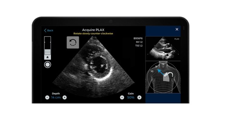 AI-guided Cardiac Imaging System Given FDA Authorisation