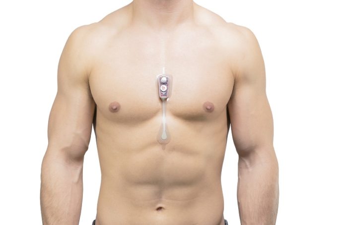 Carnation Ambulatory Monitor patch used to detect arrhythmias in COVID-19 patients