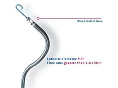 FDA issues IDE for Impella ECP and EUA for Impella RP