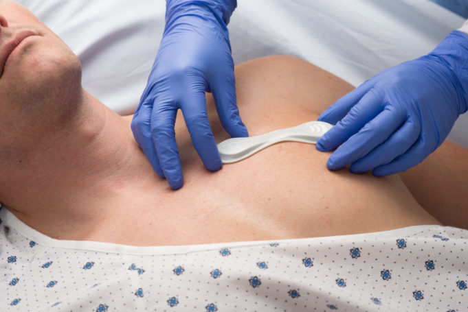 VitalConnect begins TELESTAR-TAVR remote monitoring study