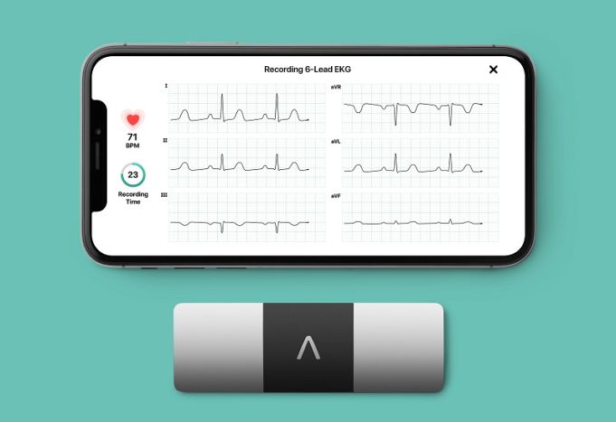 ESC 2021: AliveCor touts results of KardiaMobile 6L in AF detection study