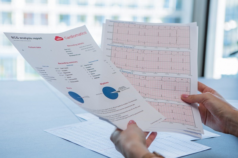 New clinical project to use AI ECG data analysis to investigate cardiac arrythmias in patients with HIV