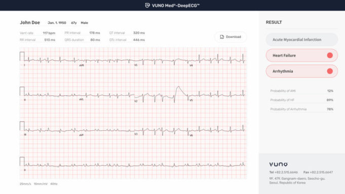 Vuno’s AI-based ECG analysis software gains breakthrough designation