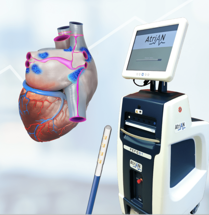 AtriAN initiates second trial of pulsed field ablation in cardiothoracic surgery patients with paroxysmal AF Atrian
