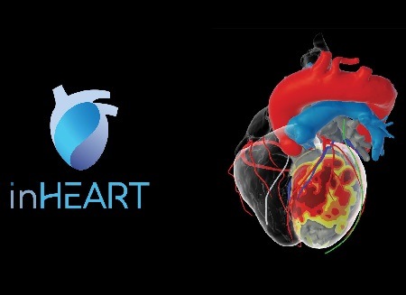 FDA approval granted for inHEART 3D imaging analysis software