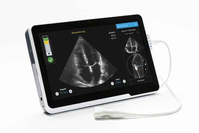 GE HealthCare to acquire AI ultrasound developer Caption Health
