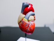 cardiac arrest