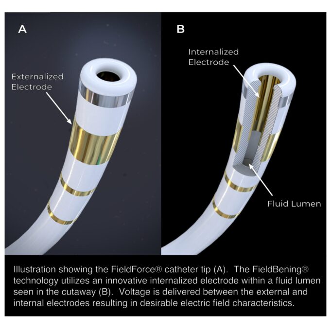 “Second-generation” PFA catheter developer Field Medical closes seed round