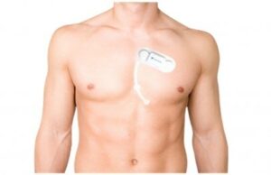 SmartCardia receives US FDA clearance for 7L monitoring patch