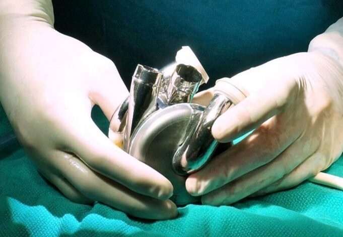 Australian government offers grant support to artificial heart programme