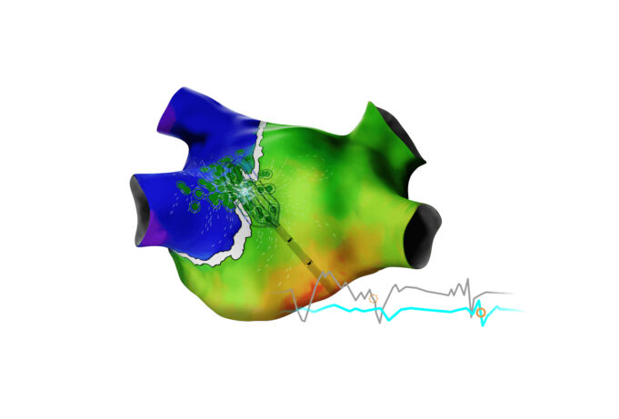 Biosense Webster launches latest generation of its Carto 3 mapping system