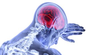 ESC 2024: Mass AF screening via ECG plus heart failure biomarker does not prevent stroke in older patients