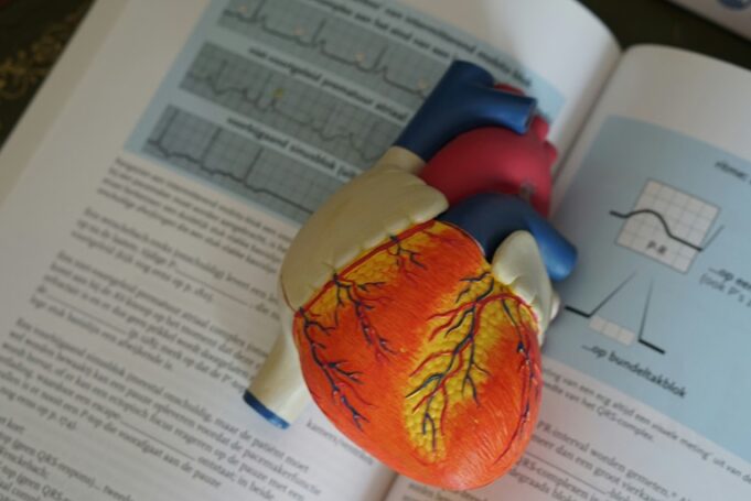 Diabetes drug reduces irregular heartbeat events in overweight adults with AF