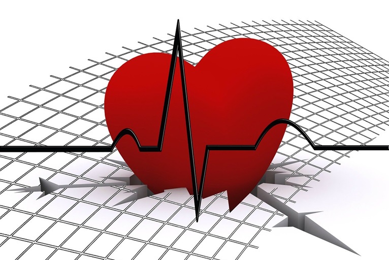 Kenyan study finds “striking” heart failure detection results with AI-powered ECG algorithm
