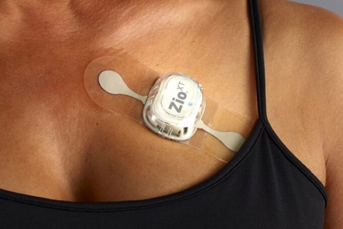 ESC 2024: Wearable monitor increases diagnoses of common heart rhythm disorder by 50%