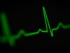 LBBAP deemed effective and practical for cardiac resynchronisation therapy