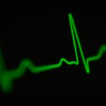 Heart rhythm pic featured
