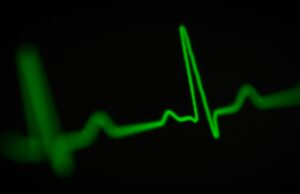 Remote AF screening using an ECG patch demonstrates modest benefits