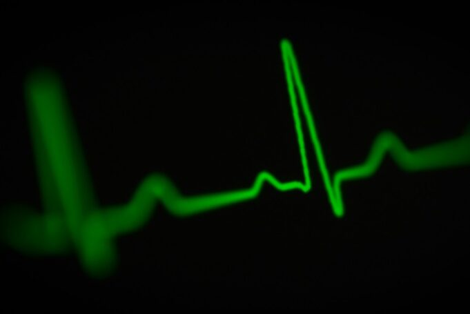 LBBAP deemed effective and practical for cardiac resynchronisation therapy