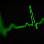 Heart rhythm pic thumbnail