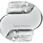Ceryx-Medical-Cysoni-Device