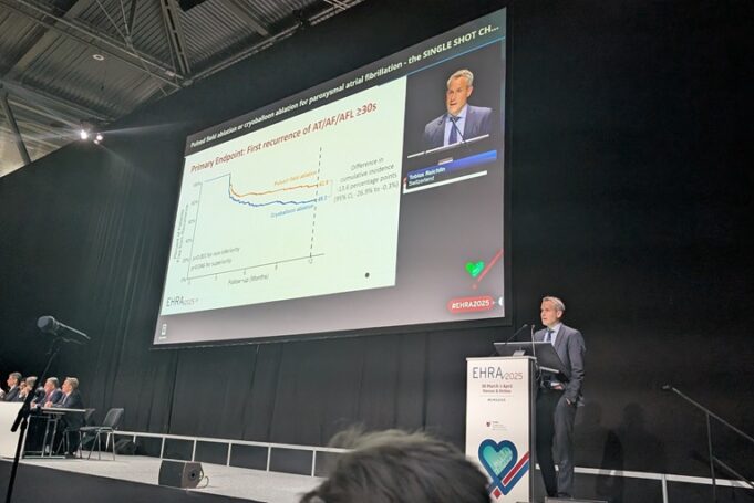 Farapulse PFA system demonstrates superior efficacy to cryoablation catheter in paroxysmal AF patients