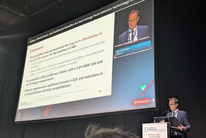 J&J’s dual-energy ablation catheter deemed safe and effective in first-in-human SmartfIRE study