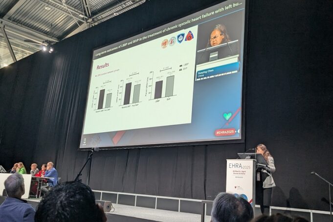 LBBP proves superior to biventricular pacing in reducing long-term mortality and heart failure