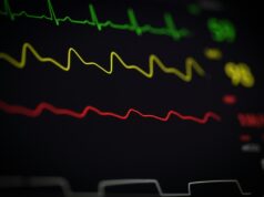 Multicentre study suggests GLP-1 receptor agonists may reduce AF-related events in obese patients