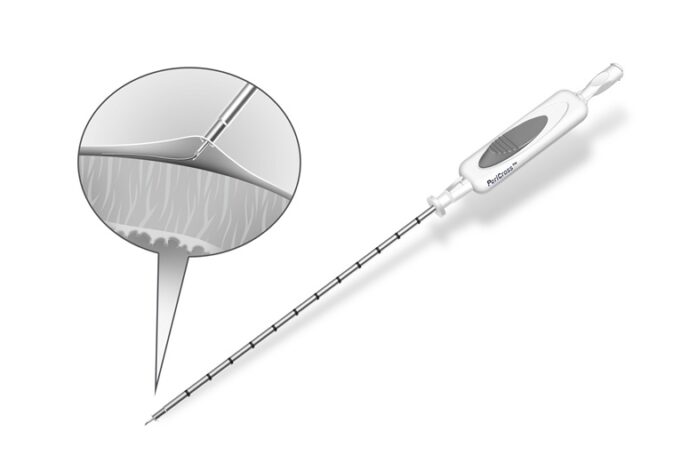 Circa Scientific announces US FDA clearance of PeriCross epicardial access kit