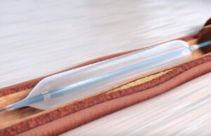 Orchestra BioMed secures additional capital from funding partners