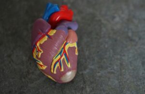 ICDs fail to reduce mortality in selected heart attack patients with abnormal cardiac rhythm markers